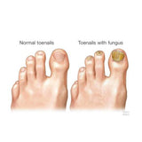 Oriundo Nail Repair Solution - 0.5 oz